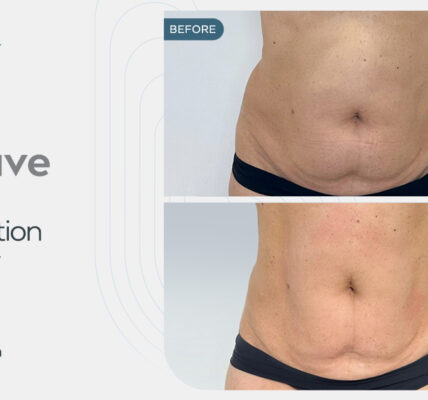 عيادة Medyed تجربة شاملة للعلاجات التجميلية والعافية المتقدمة